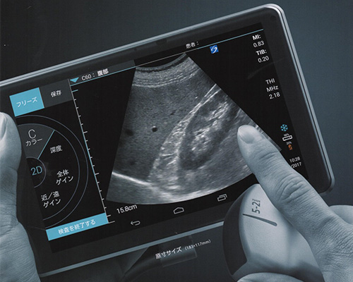 タブレット型超音波画像診断装置