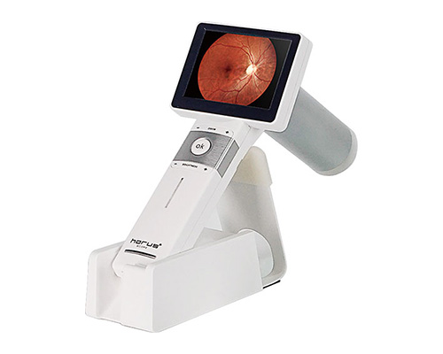 眼底カメラ
